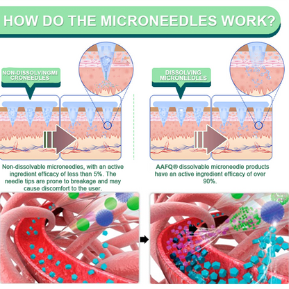 【Last Day Promotion 60% OFF🏅】AAFQ® NIDDK-Tirzepatide Slimming & Health NANO MICRONEEDLE PATCH🇳🇿 (Zero Pain, 24/7 Release | Lose 9.07 kg FAST | 90% Sugar Reduction |)🌞